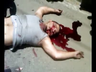 Man with face and leg ripped apart agonizing to death