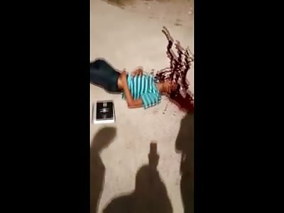 Kid in Stripped Shirt Takes His Final Breath on Camera