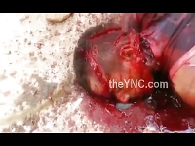 Man Hacked up By Machete Blows Slowly Dying on Camera (Wait for Gruesome Close Up Shots)