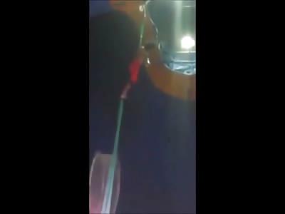 Circus Entertainer Performs his Last Show Following Horrific Accident