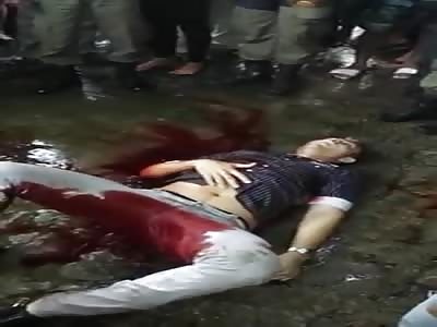 Man in Agony and a Bowl Cut Eventually Dies 