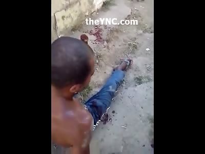 Should I just Take it Off? Man with Dangling Hand from Machete Isn't Sure What He Should Do with It