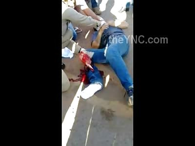 Screaming Man's Leg is Shredded to the Bone