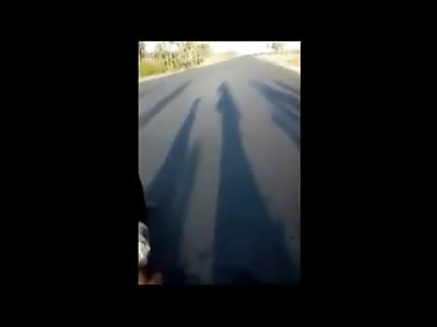 Boy with Horribly Disfigured Leg Waits for Help on the Street 