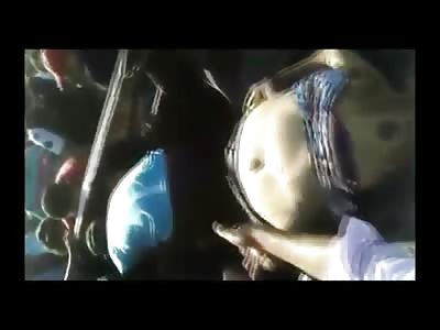 Topless Woman Aftermath in Car Accident 