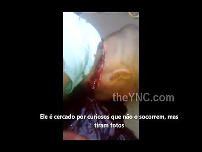 Man Hacked by Knife blows Agonizes and Dies in the Street