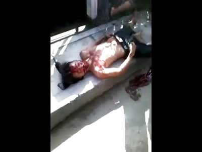 Sad Video of Young Boy Gasping his Final Breaths after being Hit by a Car 