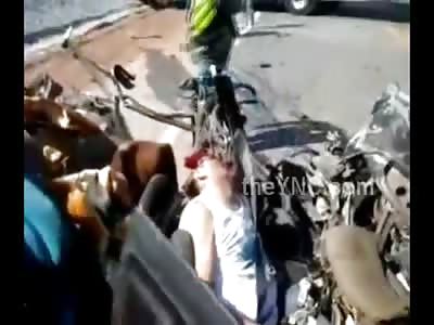 Man Scalped in Horrific Accident