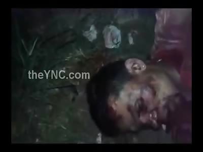 /Man Still Alive in Agony Hacked up by Machete with his Hands Tied 