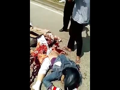 Woman with Pink and Black Lace Panties on is Like Minced Meat on the Road after Horrific Accident