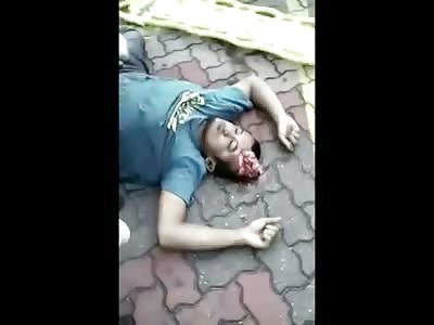 Man with Perfect Head Crack and Brain Oozing out of His Head