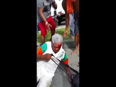 Horrible Accident Leaves Agonizing Woman With Huge Hole in Her Head