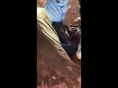 Police Officer Taking His Final Gasps of Life after Fatal Accident 