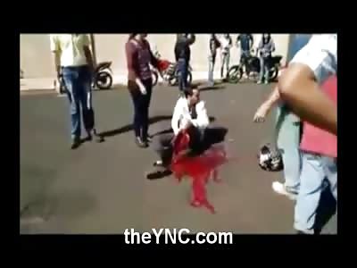 Man with his Leg Ripped Off is lifted into the Back of a Pickup Truck, they Don't Forget his Leg 