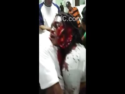 Horrific Scene Shows Woman Hacked up by Machete Arrive on Motorcycle to Hospital