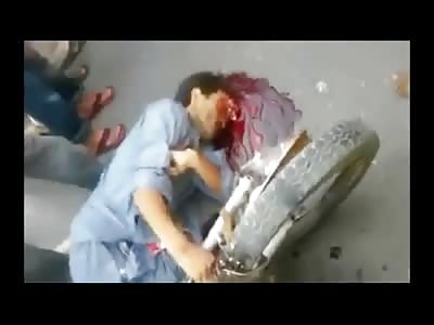 Motorcyclist Lost his Face in this Accident 