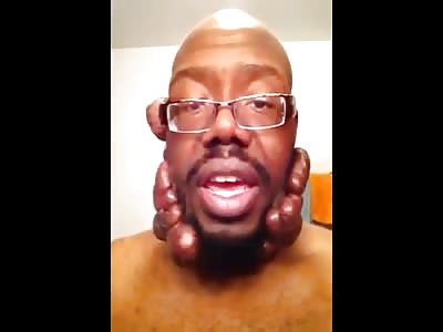 Poor Man with Horrific Scars asks for Help from Anyone Willing to Listen 