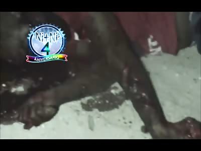 Man Hacked up with a Machete and Left on the Street