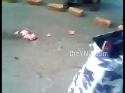 Son Grasps onto His Mother with Heads Cracked Open after Being Hit by a Truck