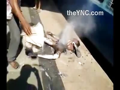 Man Severely Burned at a Railway Station 