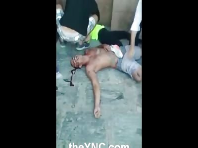 Girl Screams When She Sees Her Boyfriend in Agony after they Both Crashed off his Bike