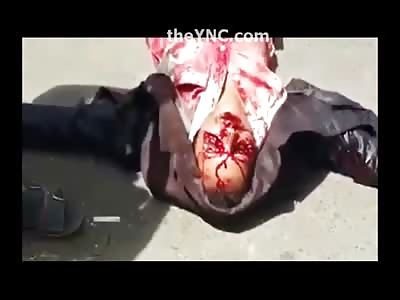 Sniper with mutilated Eyes Gurgles his Last Words 