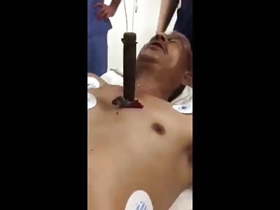 Knife Stuck in the Chest Still Moving as Heart Beats