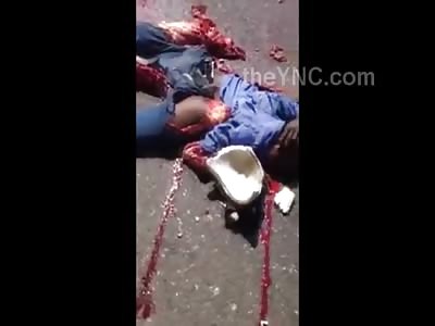 TRUE GORE: The Remains of a Man After he Was Runover by a Truck