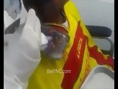 Elderly Man Has a Disgusting Hole in the Head Full of Fat Maggots