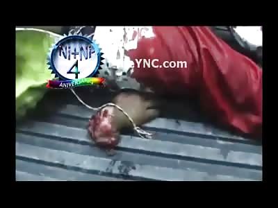 Blood Covered Man Sits Calmly in Back of Truck Missing his Hand