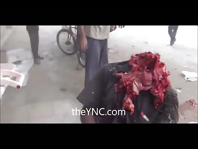 Man Sitting After Had His Head Blown Off During Bombing