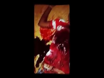 Kid with Massive Blood Loss from Stabbing taking Final Breath of Life 