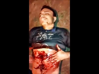 Thief Shot by Police Waits for Help With a Piece of his Intestines Exposed