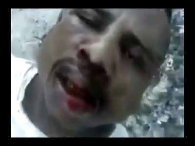 Man in a Whole World of Shit has his Ear Cut off in Painless Procedure 