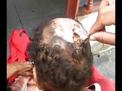 Disgusting Puss Like Wound to the Head 