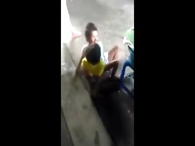 Creepy?  Siamese Twins Walking Around a Market in Thailand 