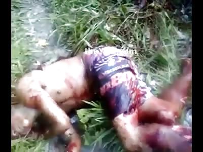 Brutal: Man Horribly Hacked by Machete is Dying 