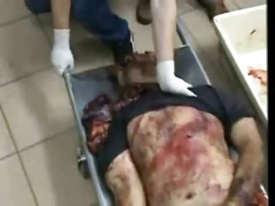 Up Close and Personal and Very Graphic Morgue Footage of Dead Girls and Guys...