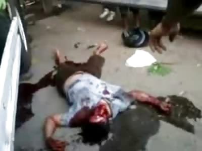 Man Gasping Final Breaths After Accident