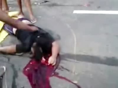 Man with Open Skull loses his Brain being Transported to the Ambulance 