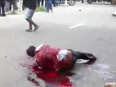 Man Left Squirming Right Arm Cut and Left Foot Cut Off by Rival Drug Cartel.....Later Dies in Hospital