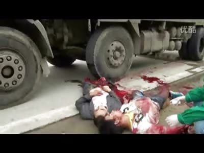 Its a Mess...and they're Alive (Watch at the End when the Man is Squiring as No one Helps Him