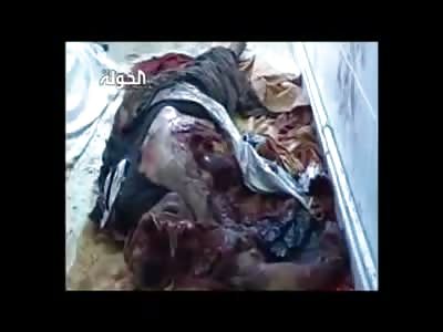 Mans Face Turned to Alien Looking Thing after Bomb Explosion