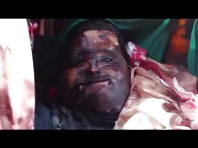 If your Going to Die You Might as Well Die Smiling