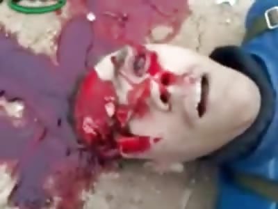 Gasping For Life Teen Slowly Dies on Camera