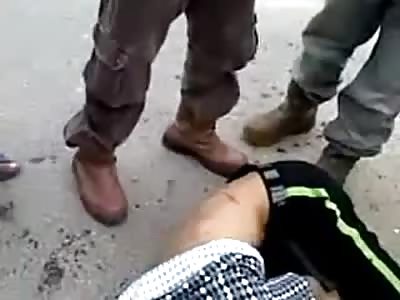 Severe Brain Hemorrhage Bleeding out the Ear