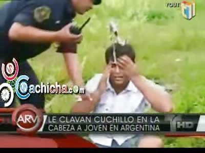 Man Stabbed in the Head Knife Embedded in Skull