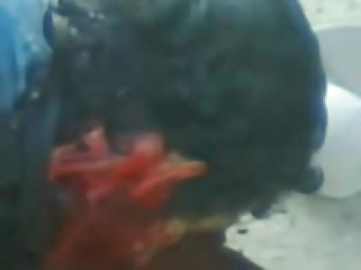 Young Boy Shot in Face Leaking Blood, Dies in Front of your Eyes