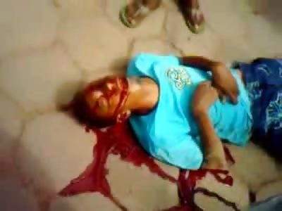 Boy Shot in the Brain leaking from Every Hole in his Face, Onlookers get the Cell Phones Out