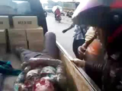 Barely Clinging to Life after Horrible Accident